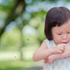 被蚊虫叮咬后应避免的行为 快速止痒的小方法